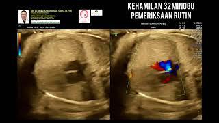 Kehamilan 33 minggu pemeriksaan rutin