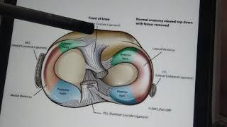 Knee Anatomy  2  Meniscus