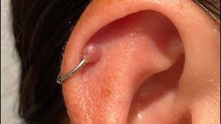 Why I took my helix piercing out￼