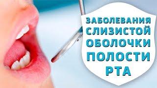 Тактика врача-стоматолога при заболеваниях слизистой оболочки полости рта Дентал ТВ