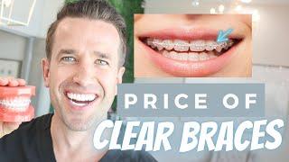Price of Clear Braces  Dr. Nate
