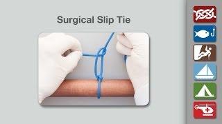 Surgical Slip Tie  How to Tie the Surgical Slip Tie