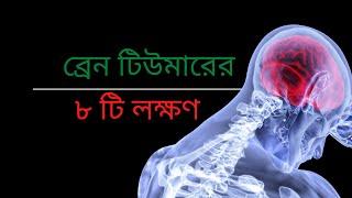 ব্রেন টিউমারের ৮ টি বিপজ্জনক লক্ষণ - 8 dangerous signs of brain tumor