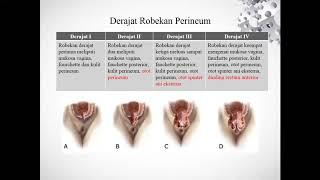 KULIAH MAHASISWA RUPTUR PERINEUM HEMATOME VULVA DAN RETENSI URIN