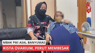 Ya Allah Perutnya Segede Ini Mbak Catur Dari Banyumas Sakit Kista Ovarium