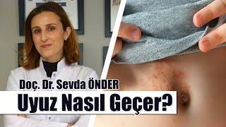 Uyuz Hastalığı Etkili ve Kesin Tedavisi Nedir?  Uyuz Nasıl Geçer Kesin Sonuç