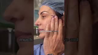 #DocTalkWithDrB Facelift Surgery  8 West Clinic - Vancouver BC