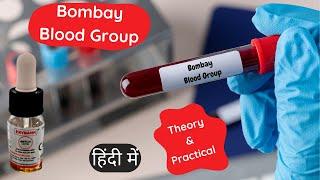 Bombay Blood Group System  Test Procedure  Kya Hai  Hindi #bloodgroup