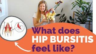 Hip bursitis What does bursitis in the hip feel like?