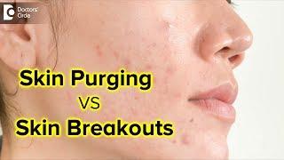 What is skin purging ? Is it the same as skin breakouts? - Dr. Rajdeep MysoreDoctors Circle