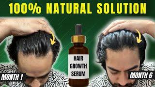 Hair fall kam hoga aur naye baal bhi aayenge  Power of hair growth serum