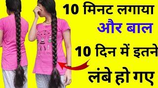 10 मिनट लगाया और बाल 10 दिन में 15 इंच बाल लंबे हो गए  long hair grow  बाल कभी नहीं झडेंगे