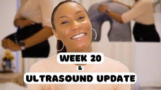 20 Week Pregnancy Update & Ultrasound update