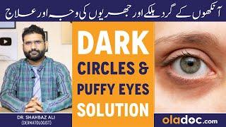 DARK CIRCLE SOLUTION - Puffy Eyes Aur Wrinkles Kyun Hote Hai- Ankhon Ke Halke Khatam Karne Ka Tarika