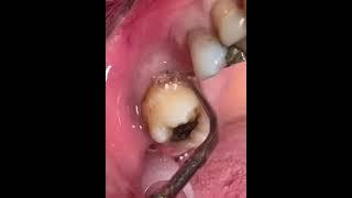 wow schock was ist das? #zähne #dental