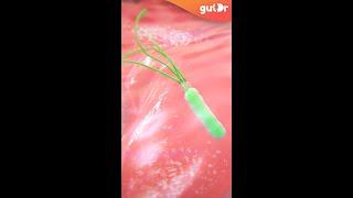 What is Gastritis and H. Pylori?  3D #Shorts