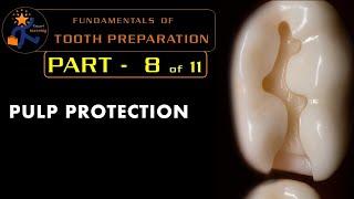 Fundamentals of tooth preparation  Part 8  Pulp protection