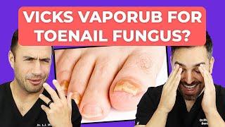 Ointment To CURE Toenail Fungus?  Doctorly Investigates