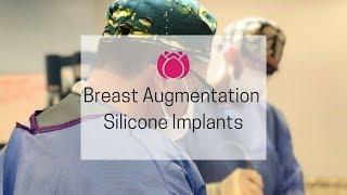 Breast Augmentation with Silicone Implants  Cosmetic Surgery Affiliates