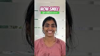 Wow smile after braces removal #bestdentistinhyderabad #dentist #trending #shorts#braces #smile