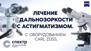 Как проходит лечение дальнозоркости с астигматизмом на лазерном оборудовании Карл Цейс.