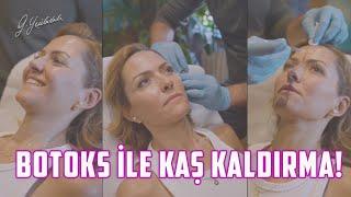 15 Dakikada Botoks İle Kaş Kaldırma Op. Dr. Güray Yeşiladalı #botoks #botox #Shorts