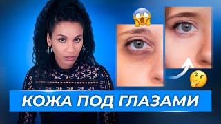 Как убрать тёмные круги и отёки под глазами?  Эффект панды простой рецепт для осветления кожи