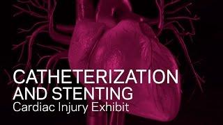Cardiac Catheterization and Stenting