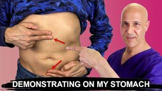 Stop Bloating & Constipation in 2 Moves Demonstrating My Stomach  Dr. Mandell
