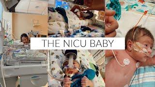 The NICU  our story c-section scar $ cost insane stories & worst moments