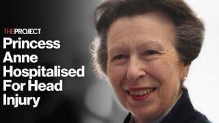 Princess Anne Hospitalised After Suffering Head Injury