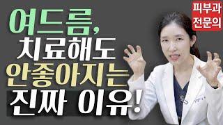 *Eng 여드름치료 실패원인 분석 Why acne treatment fails - 피부과전문의 닥터필러