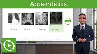 Acute Abdomen Appendicitis & Peritonitis – General Surgery  Lecturio