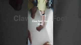 Claw foot.. #youtubeshorts #shortvideo #shorts #viral