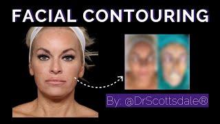 SURGICAL FACIAL CONTOURING by @DrScottsdale Bleph Plasma Pen & Chin Vaser Lipo and Magic Tight®