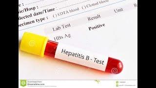 TERNYATA INI PENYEBAB HEPATITIS B PADA IBU HAMIL YANG SAMA DENGAN GEJALA HAMIL