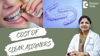 Invisible Clear Aligners Types & Cost in India - Dr. Divyashree Rajendra  Doctors Circle