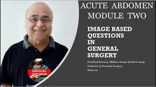 ACUTE ABDOMEN – Module 2- CaseImage Based Discussion