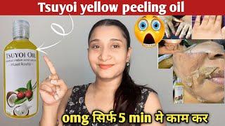 tsuyoi oil skin whitening yellow peel Tsuyoi Oil Skin Whitening Yellow Peel honest review  2024