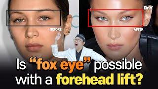 Facelift FAQ Is it possible for an eye lift like cat-eyes during a forehead lift?