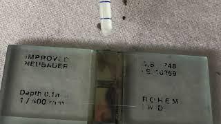 Total Leucocyte count TLC Practical Medical