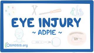 Eye injury Nursing Process ADPIE