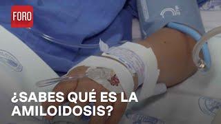 Día mundial de las enfermedades raras ¿Qué es la amiloidosis hereditaria? - Las Noticias