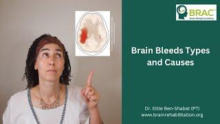 Brain Bleed Types and Causes