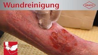 Wound cleansing debridement in chronic wounds - Dressing changes  DRACO