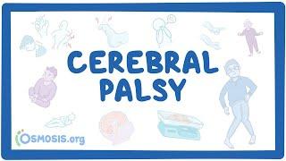 Cerebral palsy CP - causes symptoms diagnosis treatment pathology