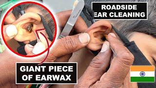 Ear Cleaning a Small Boy at Indian street  Earwax or animal?  Vijayawada