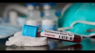 Coronavirus Ecco Cosè