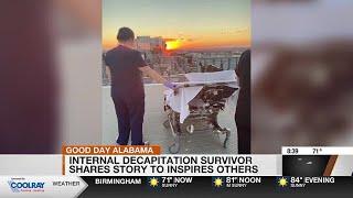 Internal Decapitation survivor shares story to inspire others