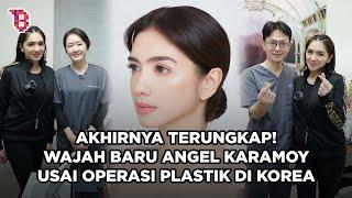 Potret terbaru Angel Karamoy usai operasi plastik di Korea dipuji cantik natural